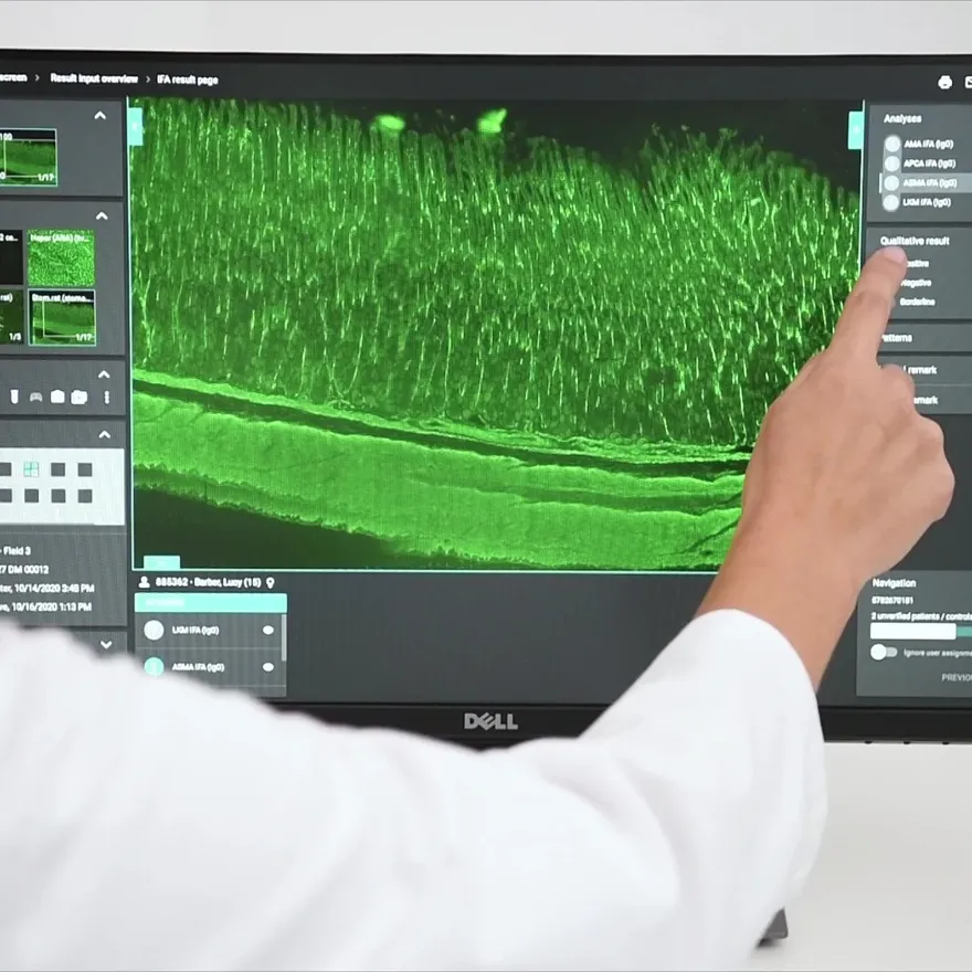 EUROIMMUN EUROPattern Microscope Live: a specialist reviews an immunofluorescence image on the touchscreen
